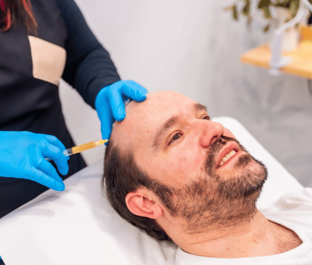 A patient undergoing professional hair transplant care services in Dubai, with a specialist providing detailed and precise treatment in a state-of-the-art clinic.